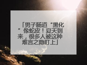 男子肠道“黑化”像蛇皮！夏天到来，很多人被这种难言之隐盯上